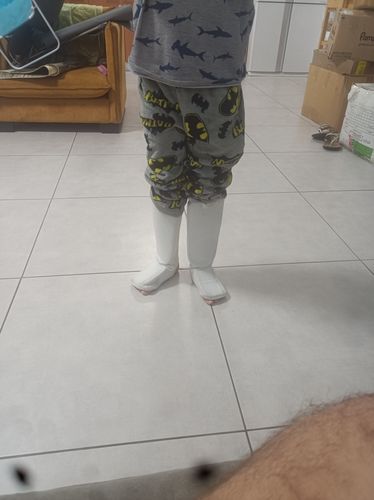 Customer photo review of מגני רגליים Bashgal