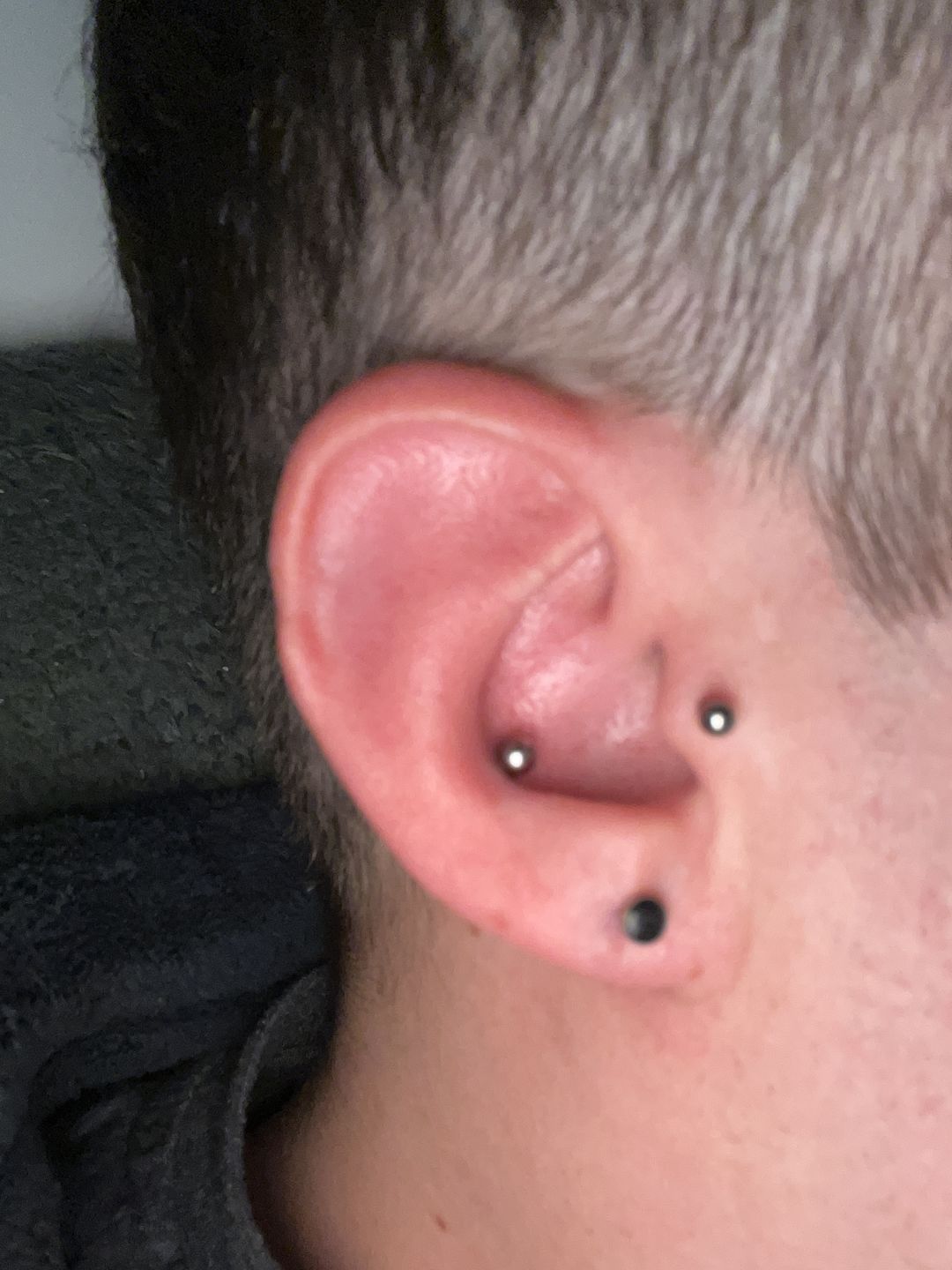 Customer photo review of Junipurr Titanium Flatback Labret Threadless