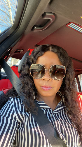 Customer photo review of Fair and White So White Hydra Sweet Moisturizing Body Lotion with Sweet Almond Oil 500ml/ 16.90 fl oz