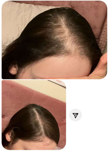 Customer photo review of Growth & Shine Hair Oil