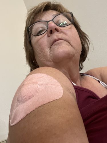 Customer photo review of Skin Grip Original - Medtronic Guardian/Enlite Adhesive Patches