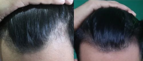 Customer photo review of Ultimate Hair Accelerator Bundle