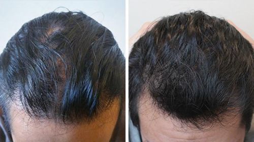 Customer photo review of Complete Hair Growth System