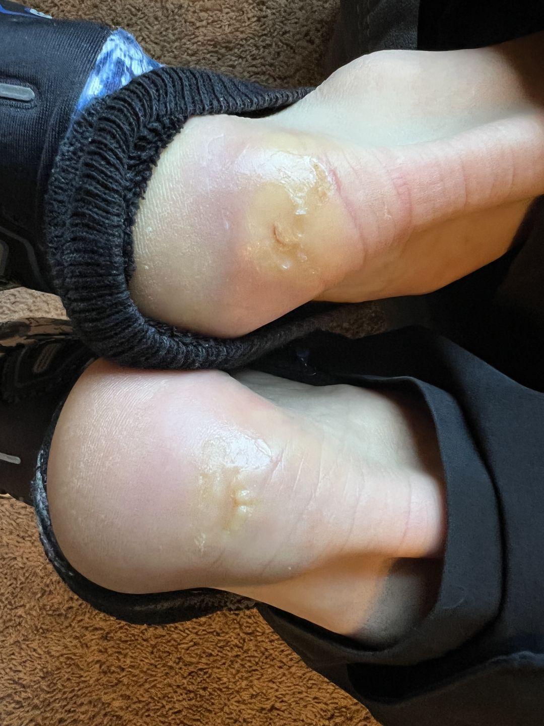 Customer photo review of Combat Ready Ointment - Triple Threat