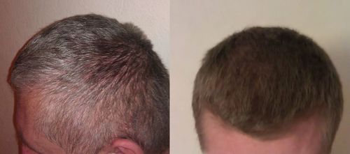 Customer photo review of Gray Reverse Bar 3-Pack - Sale