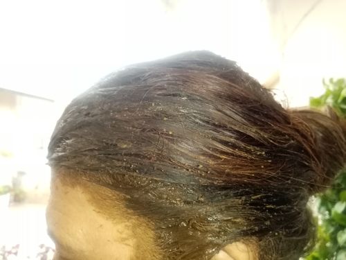 Customer photo review of Henna Hair and Beard Dye (Chocolate & Coffee) – Prevents Premature Hair Greying, Improves Scalp Health, Balances pH & Oil Production