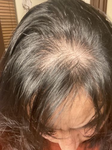 Customer photo review of Growth & Shine Hair Oil