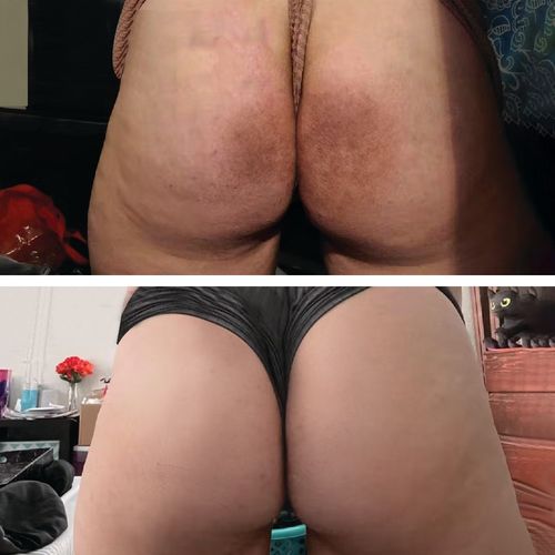 Customer photo review of Intimate Lightening Cream