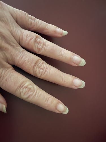 Customer photo review of Rocket Nail Fuel Nail Repair - Clear