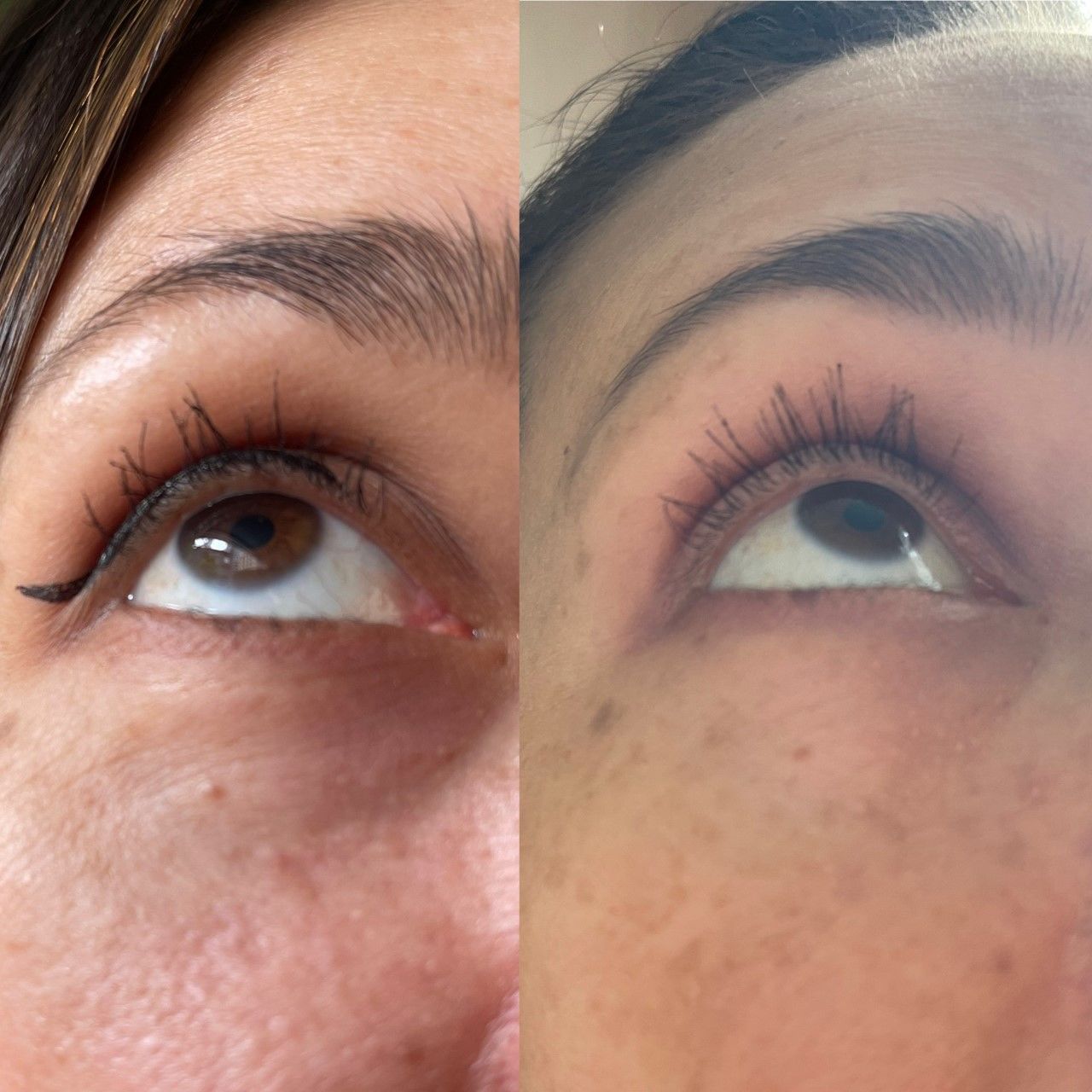Customer photo review of Eyelash Growth Serum - Original