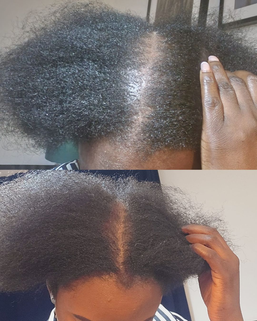 Customer photo review of Hair Growth Potion - Extra Strength