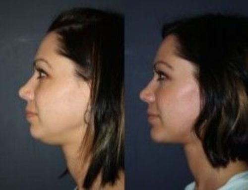 Customer photo review of JANSIO Threanic Triple-Spin Ring（Limited time discount 🔥 last day）