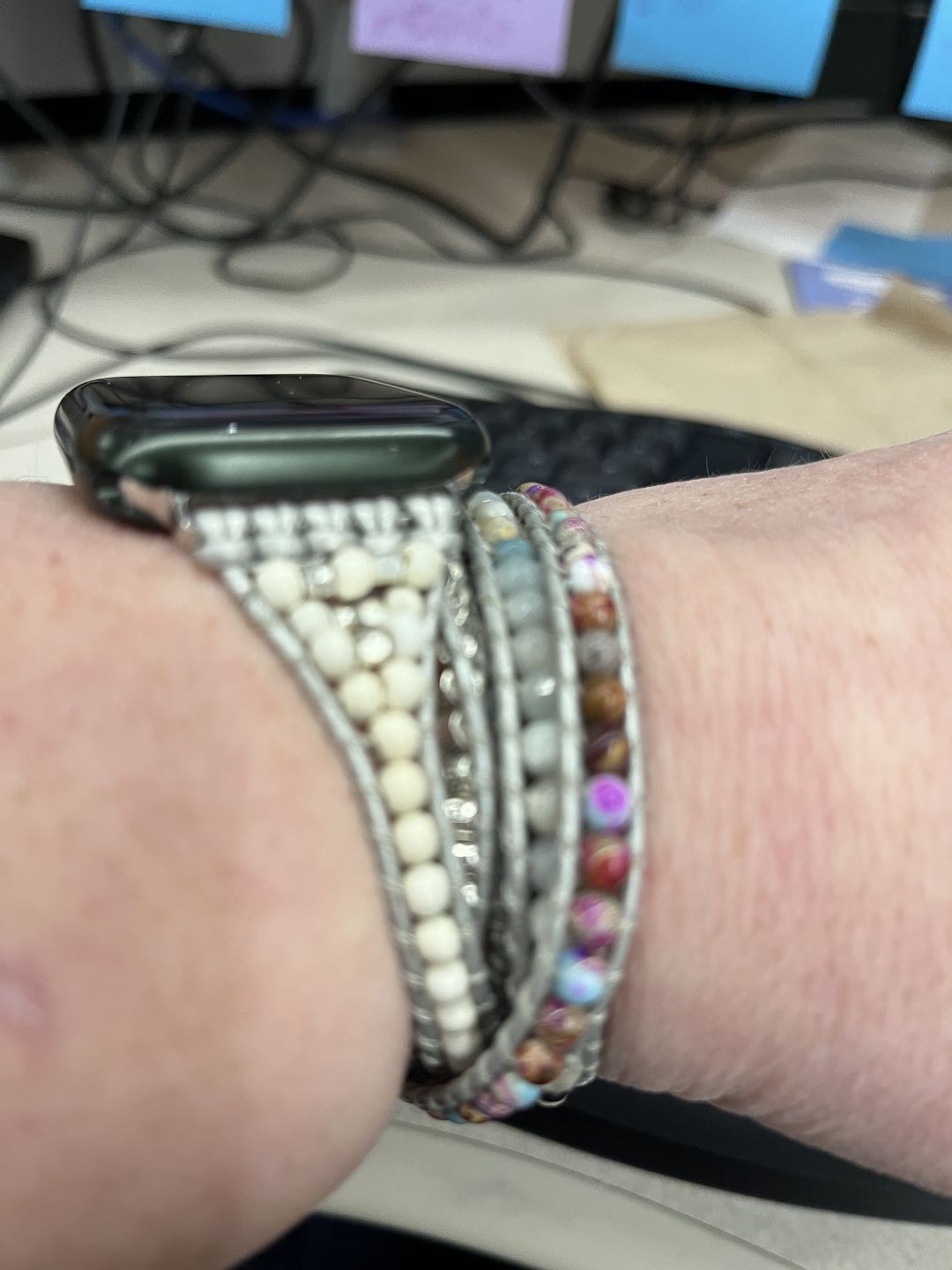 Customer photo review of Healing Turquoise Protection Apple Watch Strap