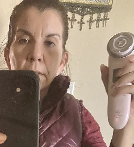 Customer photo review of EvenSkyn® Lumo: Premium Anti-Aging & Skin Tightening Handset