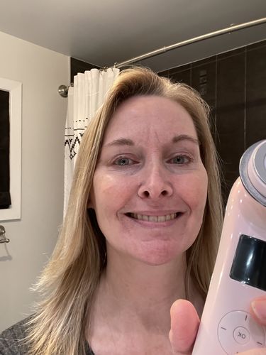 Customer photo review of EvenSkyn® Lumo: Premium Anti-Aging & Skin Tightening Handset