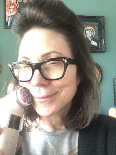 Customer photo review of EvenSkyn® Lumo: Premium Anti-Aging & Skin Tightening Handset