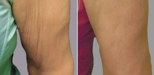 Customer photo review of JANSIO Threanic Triple-Spin Ring（Limited time discount 🔥 last day）