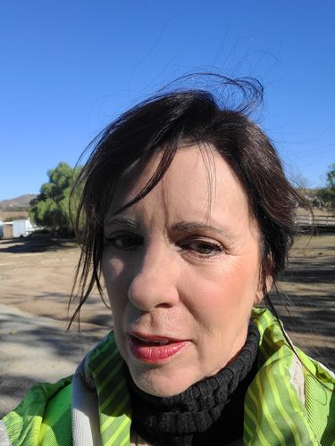 Customer photo review of EvenSkyn® Lumo: Premium Anti-Aging & Skin Tightening Handset