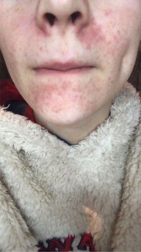 Customer photo review of Cleanser