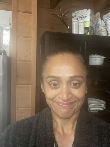 Customer photo review of EvenSkyn® Lumo: Premium Anti-Aging & Skin Tightening Handset