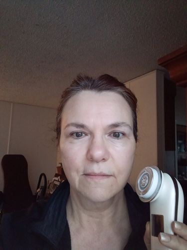Customer photo review of EvenSkyn® Lumo: Premium Anti-Aging & Skin Tightening Handset