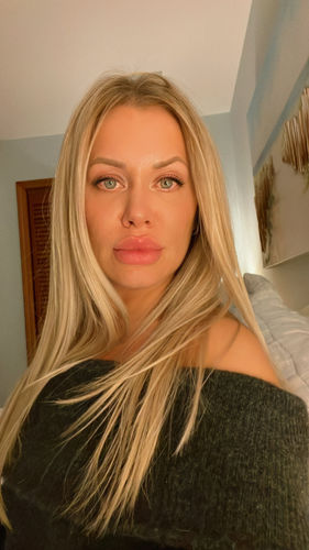 Customer photo review of EvenSkyn® Lumo: Premium Anti-Aging & Skin Tightening Handset