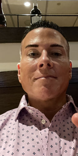 Customer photo review of EvenSkyn® Lumo: Premium Anti-Aging & Skin Tightening Handset