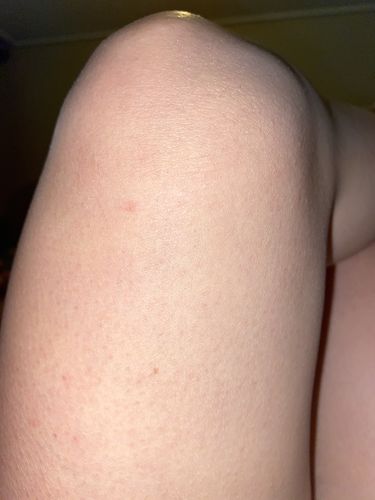 Customer photo review of Depilador Nuva Skin®