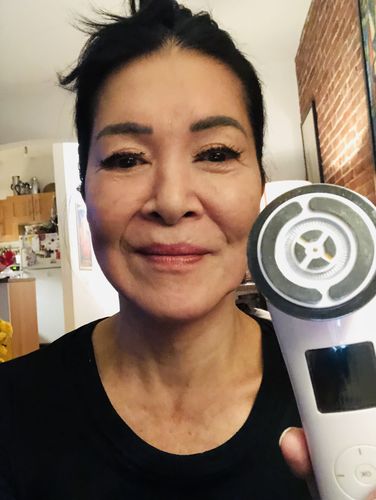 Customer photo review of EvenSkyn® Lumo: Premium Anti-Aging & Skin Tightening Handset
