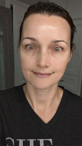 Customer photo review of EvenSkyn® Lumo: Premium Anti-Aging & Skin Tightening Handset