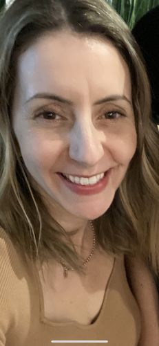 Customer photo review of EvenSkyn® Lumo: Premium Anti-Aging & Skin Tightening Handset