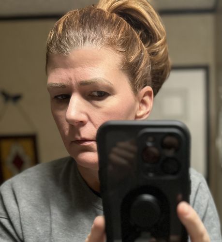 Customer photo review of EvenSkyn® Lumo: Premium Anti-Aging & Skin Tightening Handset