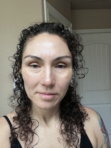 Customer photo review of EvenSkyn® Lumo: Premium Anti-Aging & Skin Tightening Handset