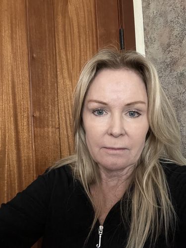 Customer photo review of EvenSkyn® Lumo: Premium Anti-Aging & Skin Tightening Handset