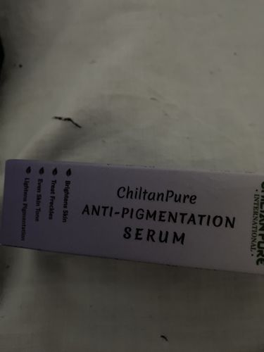 Customer photo review of Anti-Pigmentation Serum – Brighten Skin, Lighten Pigmentation, Fade Freckles & Even Skin Tone 30ml