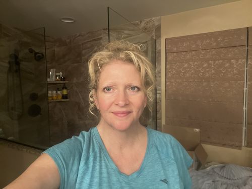 Customer photo review of EvenSkyn® Lumo: Premium Anti-Aging & Skin Tightening Handset