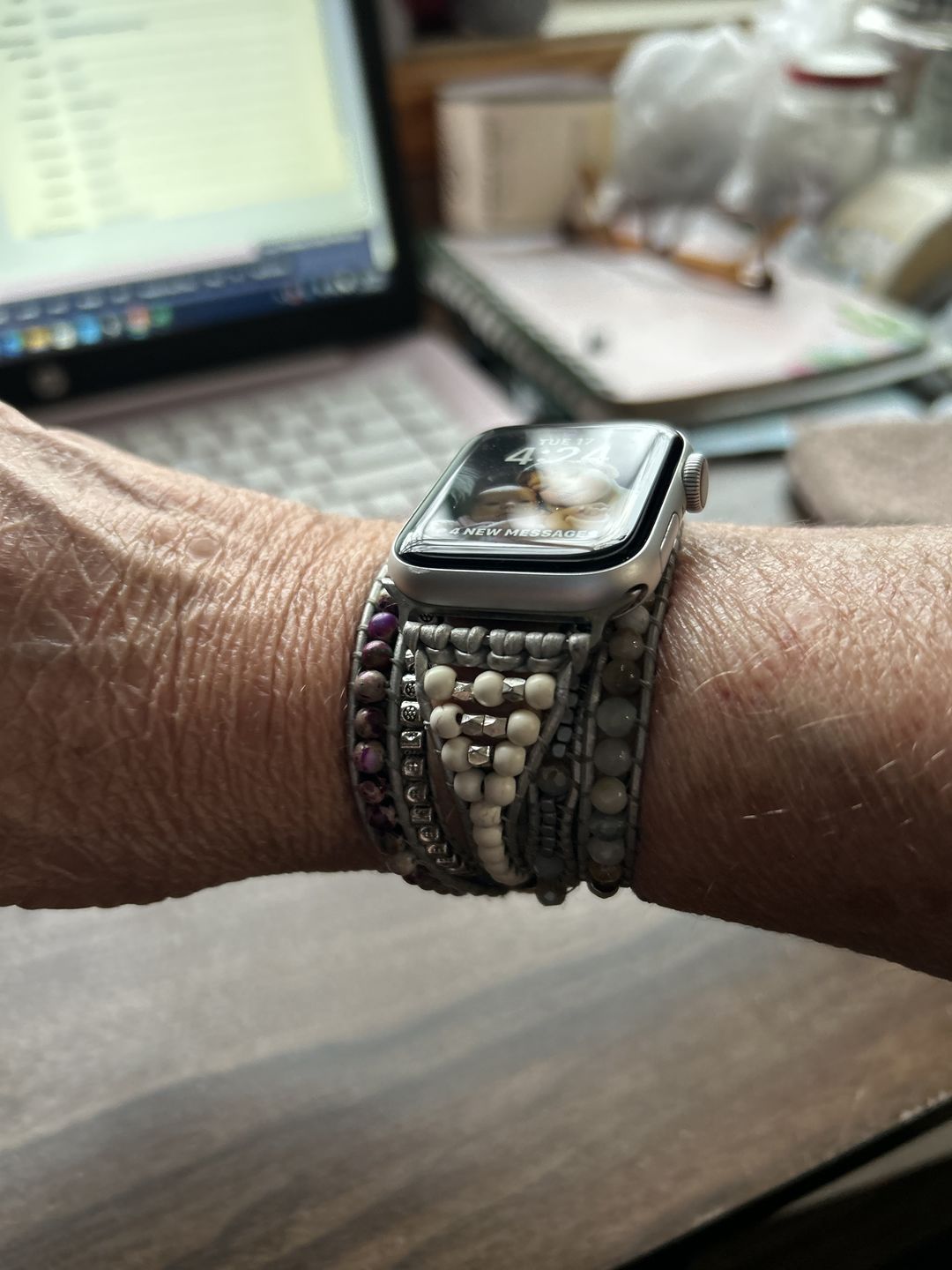 Customer photo review of Healing Turquoise Protection Apple Watch Strap