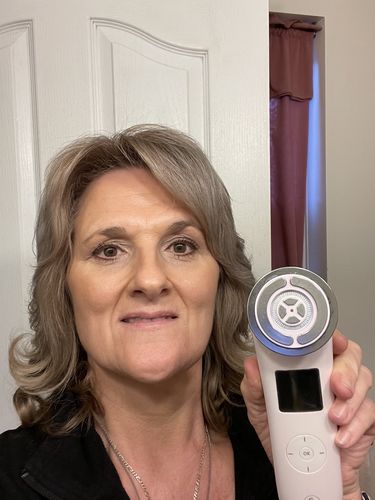 Customer photo review of EvenSkyn® Lumo: Premium Anti-Aging & Skin Tightening Handset