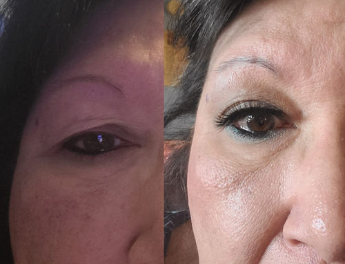 Customer photo review of MagiskaEyelids™ Osynliga Ögonlocksmeshstrips