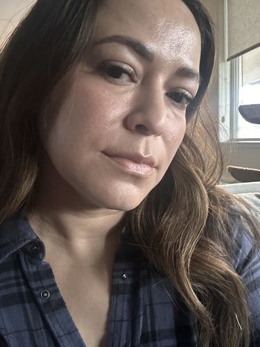 Customer photo review of EvenSkyn® Lumo: Premium Anti-Aging & Skin Tightening Handset