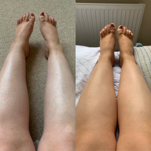 Customer photo review of SkinRevive™ Död Hud Exfolierande Olja
