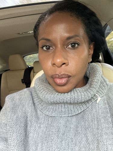 Customer photo review of EvenSkyn® Lumo: Premium Anti-Aging & Skin Tightening Handset