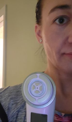 Customer photo review of EvenSkyn® Lumo: Premium Anti-Aging & Skin Tightening Handset