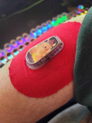 Customer photo review of Skin Grip Original - Dexcom G6 Patches