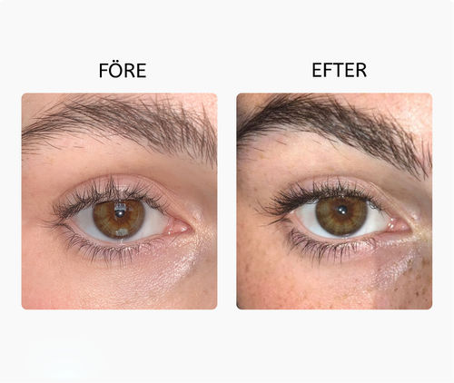 Customer photo review of ThickBrows™ Snabbväxande Ögonbrynsserum