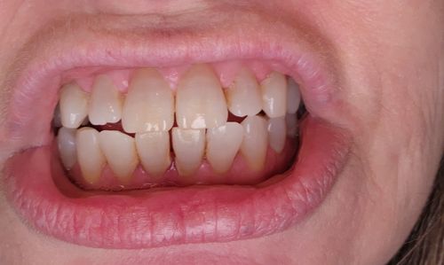 Customer photo review of Poshmamma Oral Care Routine Kit 1.0