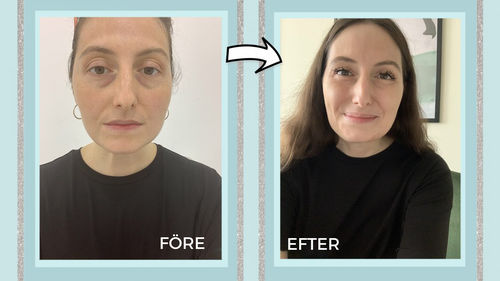Customer photo review of EyebagsRemover™