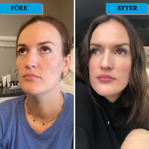 Customer photo review of EyebagsRemover™