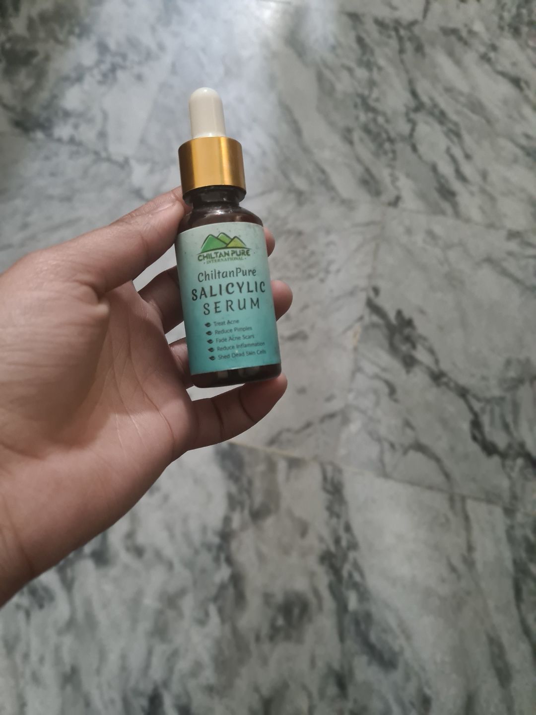 Customer photo review of Salicylic Serum - Amazing Serum for Acne Reduction