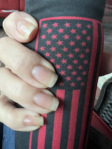 Customer photo review of Rocket Nail Fuel Nail Repair - Clear